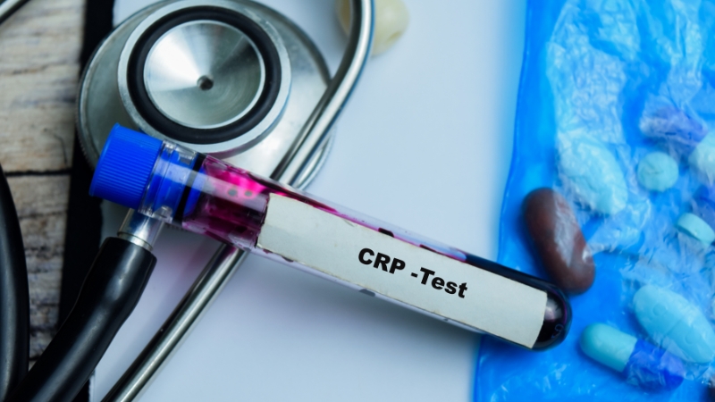 Epruveta sa uzorkom krvi označena kao CRP test, pored stetoskopa i lekova