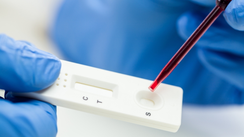 Ruka u medicinskoj rukavici nanosi kap krvi na brzi test kasetu za CRP analizu